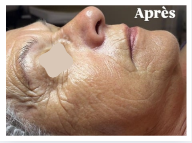 Soins du visage dans votre institut de beauté à Estrées-Saint-Denis (Moyvillers)